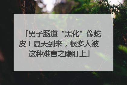 男子肠道“黑化”像蛇皮！夏天到来，很多人被这种难言之隐盯上